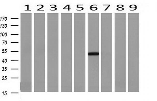 TASP1 Antibody in Western Blot (WB)