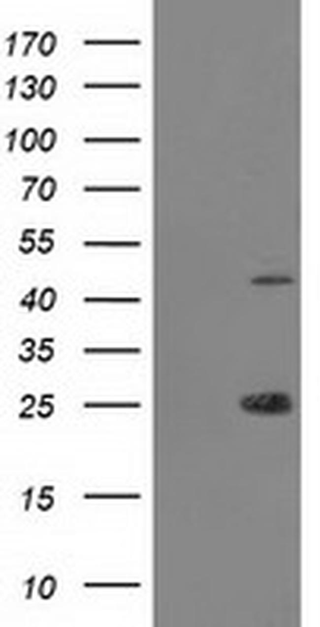 TASP1 Antibody in Western Blot (WB)