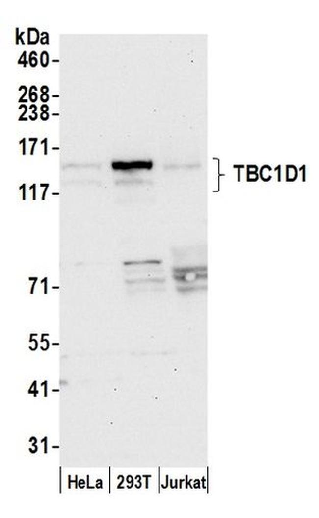 TBC1D1 Antibody in Western Blot (WB)