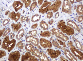 TBC1D13 Antibody in Immunohistochemistry (Paraffin) (IHC (P))