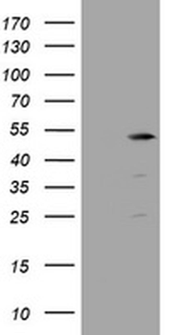 TBC1D13 Antibody in Western Blot (WB)