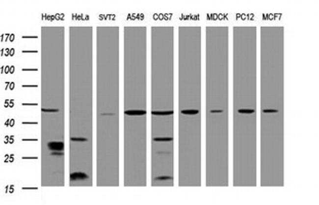 TBC1D13 Antibody in Western Blot (WB)