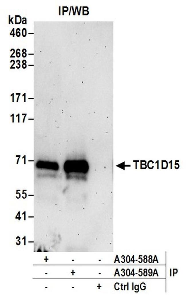 TBC1D15 Antibody in Western Blot (WB)
