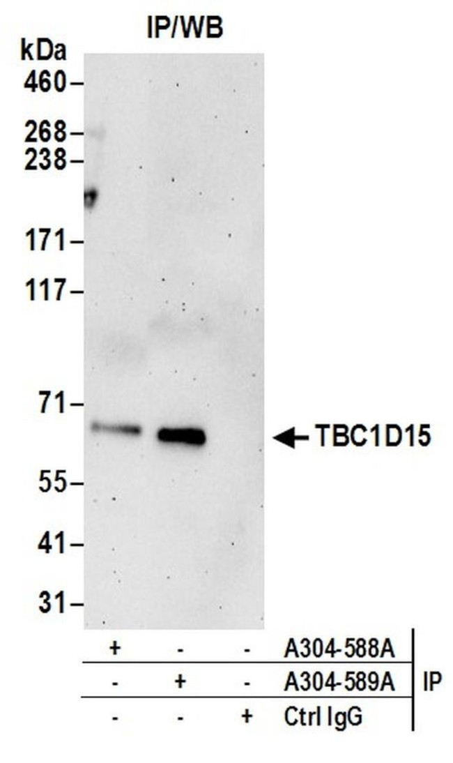 TBC1D15 Antibody in Immunoprecipitation (IP)