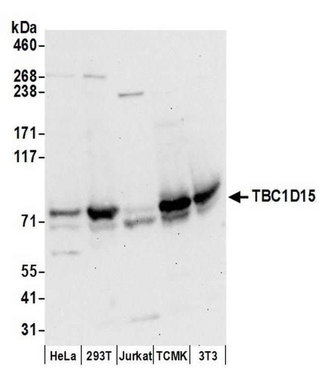 TBC1D15 Antibody in Western Blot (WB)