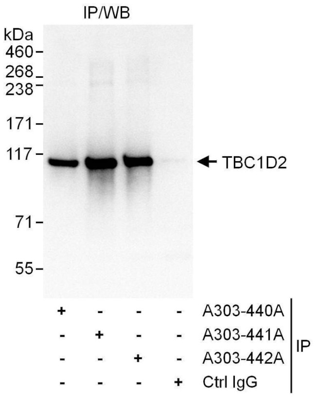 TBC1D2 Antibody in Immunoprecipitation (IP)