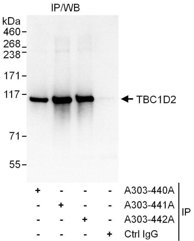 TBC1D2 Antibody in Immunoprecipitation (IP)