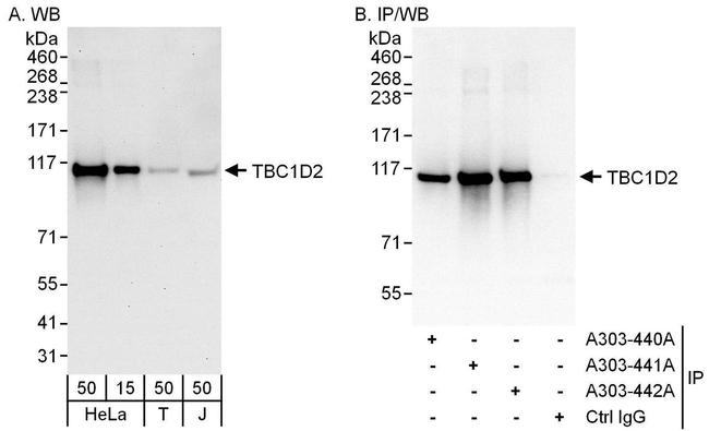 TBC1D2 Antibody in Western Blot (WB)