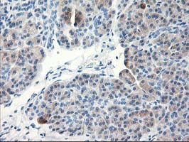 TBC1D21 Antibody in Immunohistochemistry (Paraffin) (IHC (P))