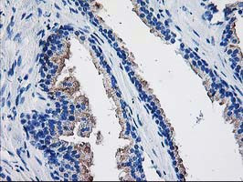 TBC1D21 Antibody in Immunohistochemistry (Paraffin) (IHC (P))