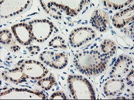 TBC1D21 Antibody in Immunohistochemistry (Paraffin) (IHC (P))