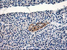 TBC1D21 Antibody in Immunohistochemistry (Paraffin) (IHC (P))