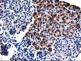 TBC1D21 Antibody in Immunohistochemistry (Paraffin) (IHC (P))