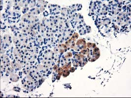 TBC1D21 Antibody in Immunohistochemistry (Paraffin) (IHC (P))