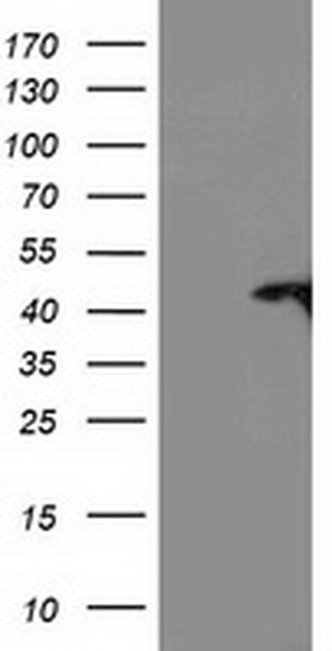 TBC1D21 Antibody in Western Blot (WB)