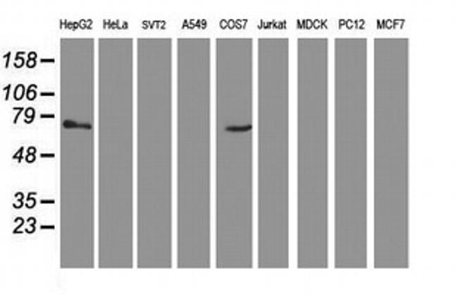 TBC1D21 Antibody in Western Blot (WB)