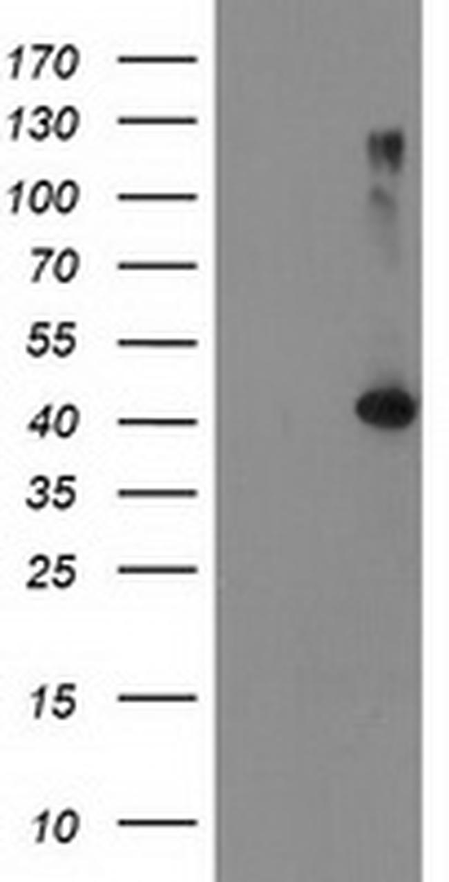 TBC1D21 Antibody in Western Blot (WB)