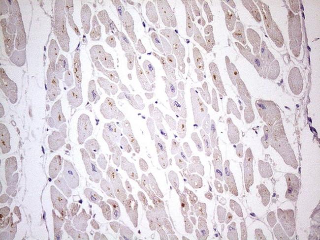 TBC1D28 Antibody in Immunohistochemistry (Paraffin) (IHC (P))