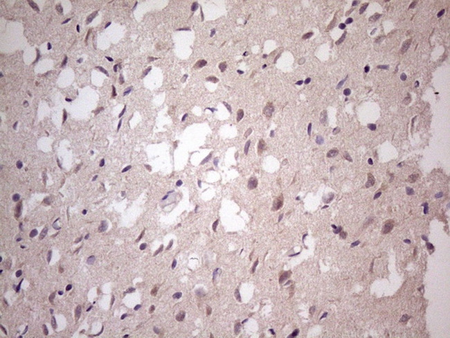 TBC1D28 Antibody in Immunohistochemistry (Paraffin) (IHC (P))