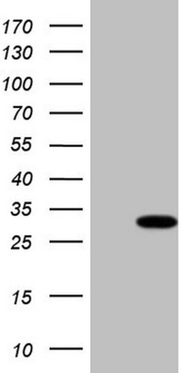 TBC1D28 Antibody in Western Blot (WB)