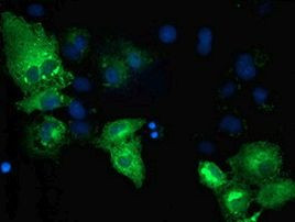 TBC1D4 Antibody in Immunocytochemistry (ICC/IF)