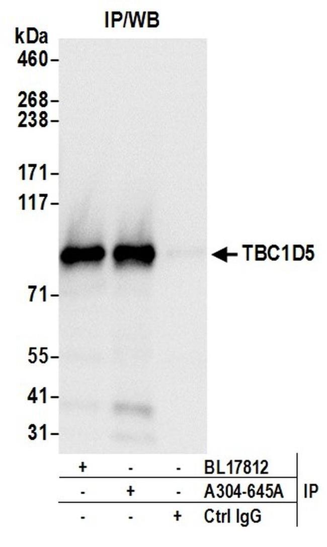 TBC1D5 Antibody in Western Blot (WB)