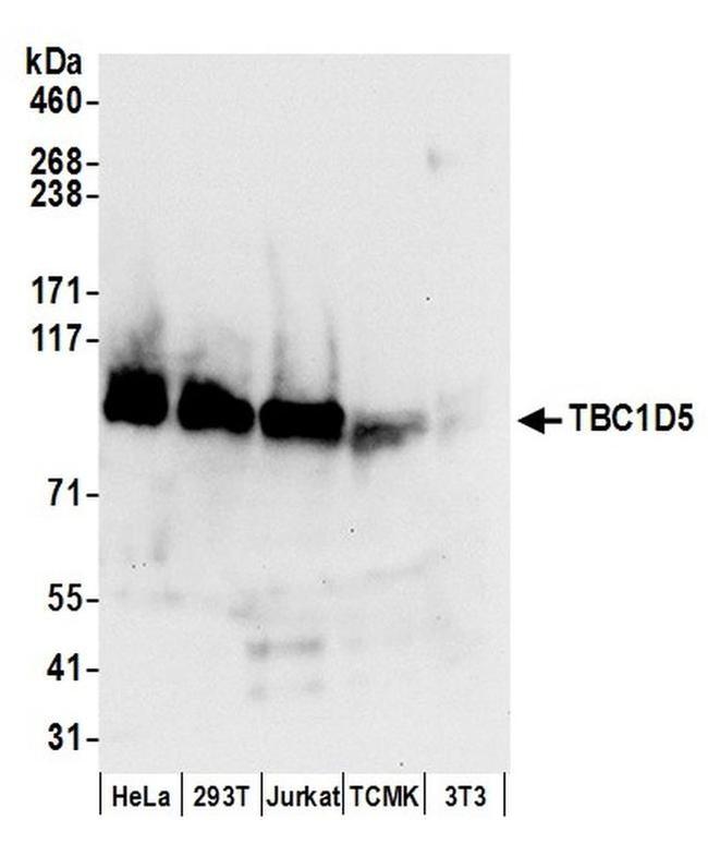 TBC1D5 Antibody in Western Blot (WB)