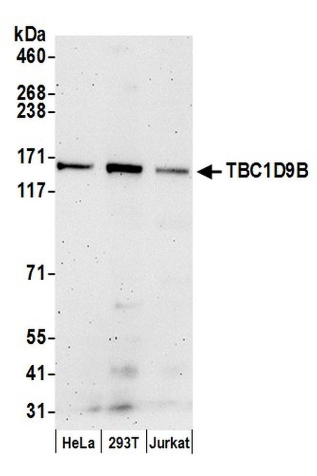 TBC1D9B Antibody in Western Blot (WB)