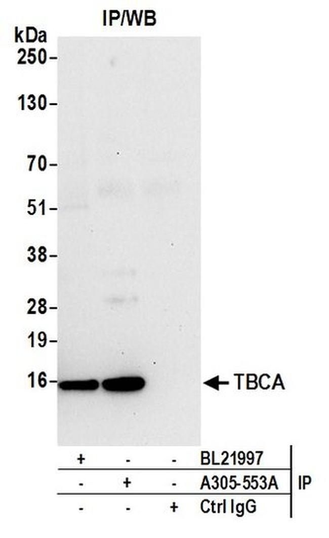 TBCA Antibody in Western Blot (WB)