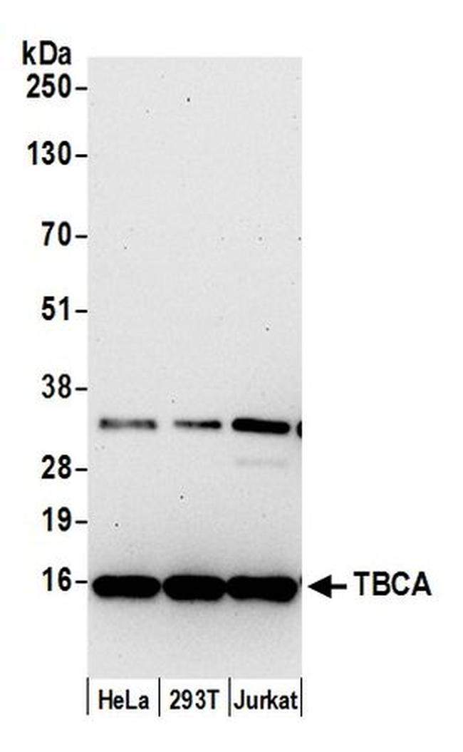 TBCA Antibody in Western Blot (WB)