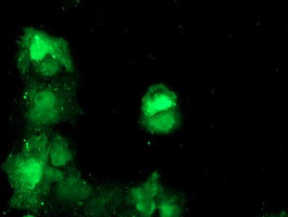 TBCC Antibody in Immunocytochemistry (ICC/IF)