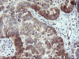 TBCC Antibody in Immunohistochemistry (Paraffin) (IHC (P))