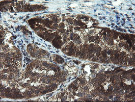 TBCC Antibody in Immunohistochemistry (Paraffin) (IHC (P))