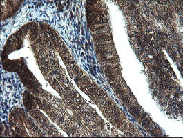 TBCC Antibody in Immunohistochemistry (Paraffin) (IHC (P))