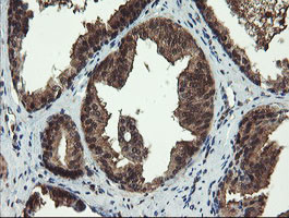 TBCC Antibody in Immunohistochemistry (Paraffin) (IHC (P))