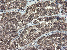 TBCC Antibody in Immunohistochemistry (Paraffin) (IHC (P))