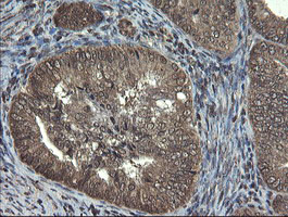 TBCC Antibody in Immunohistochemistry (Paraffin) (IHC (P))