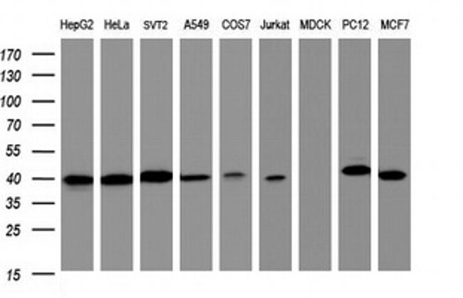 TBCC Antibody in Western Blot (WB)