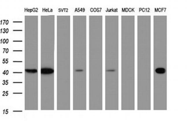 TBCC Antibody in Western Blot (WB)