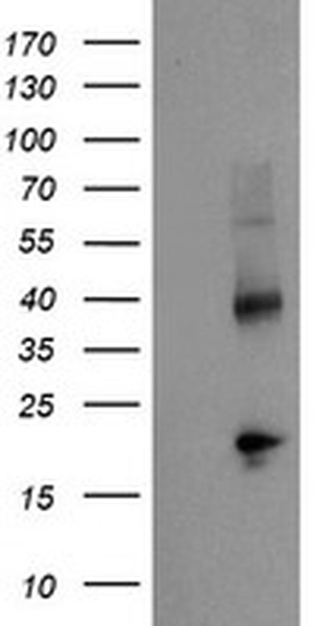 TBCC Antibody in Western Blot (WB)