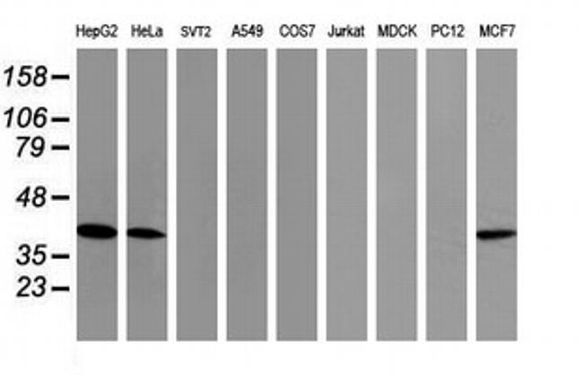 TBCC Antibody in Western Blot (WB)