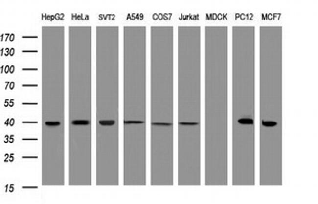 TBCC Antibody in Western Blot (WB)