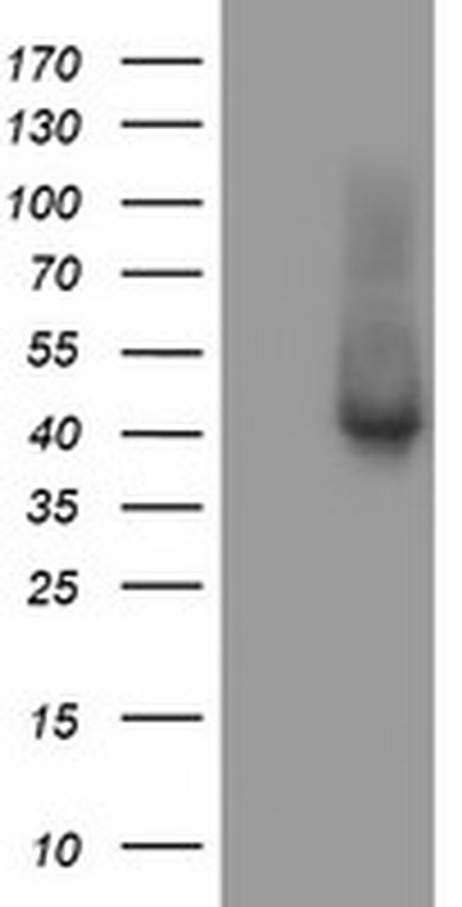 TBCC Antibody in Western Blot (WB)