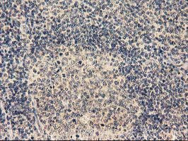 TBCEL Antibody in Immunohistochemistry (Paraffin) (IHC (P))