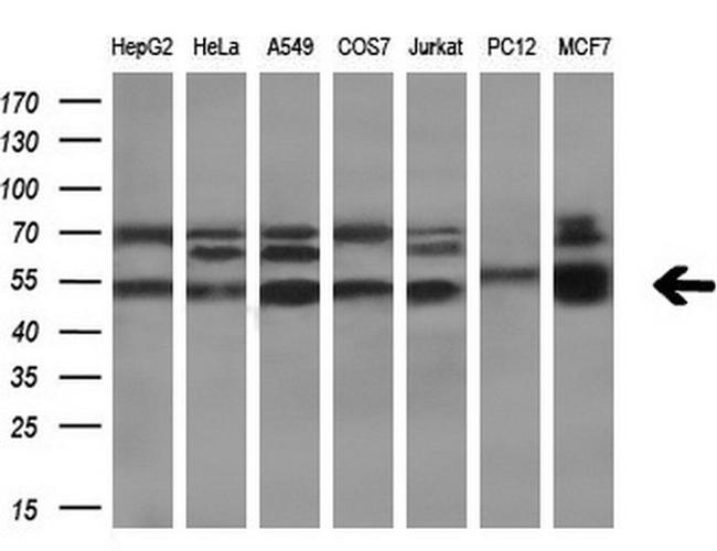 TBCEL Antibody in Western Blot (WB)