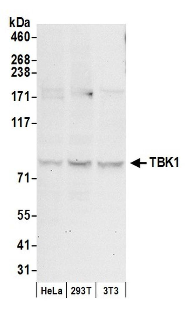 TBK1 Antibody in Western Blot (WB)