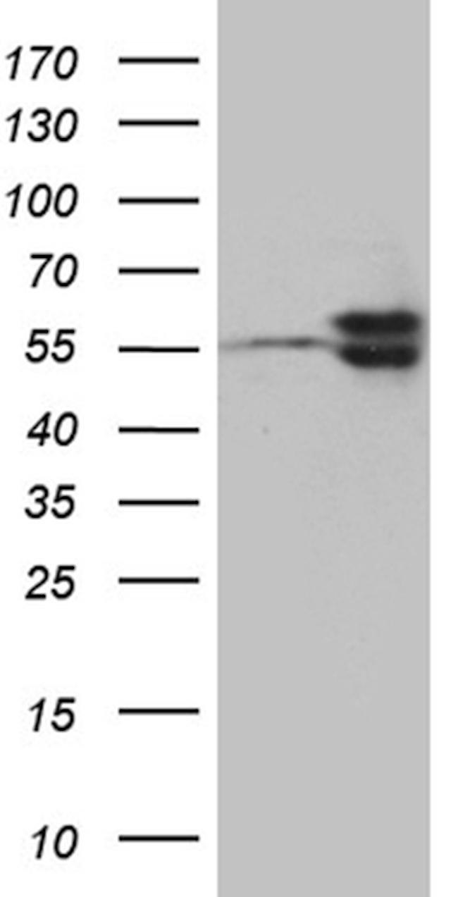 TBL1XR1 Antibody in Western Blot (WB)