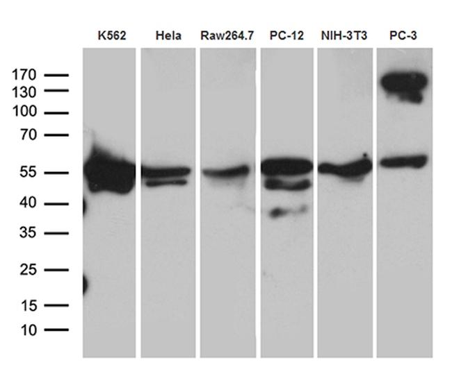 TBL1XR1 Antibody in Western Blot (WB)