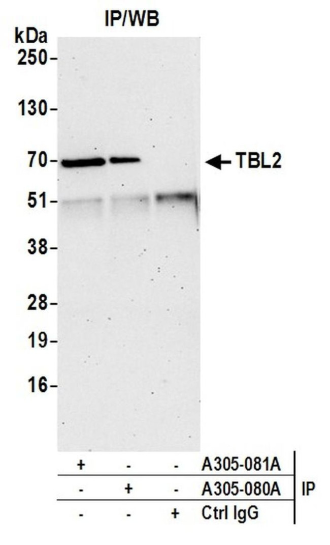 TBL2 Antibody in Immunoprecipitation (IP)