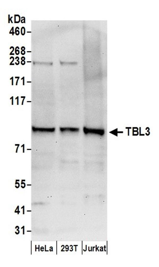 TBL3 Antibody in Western Blot (WB)